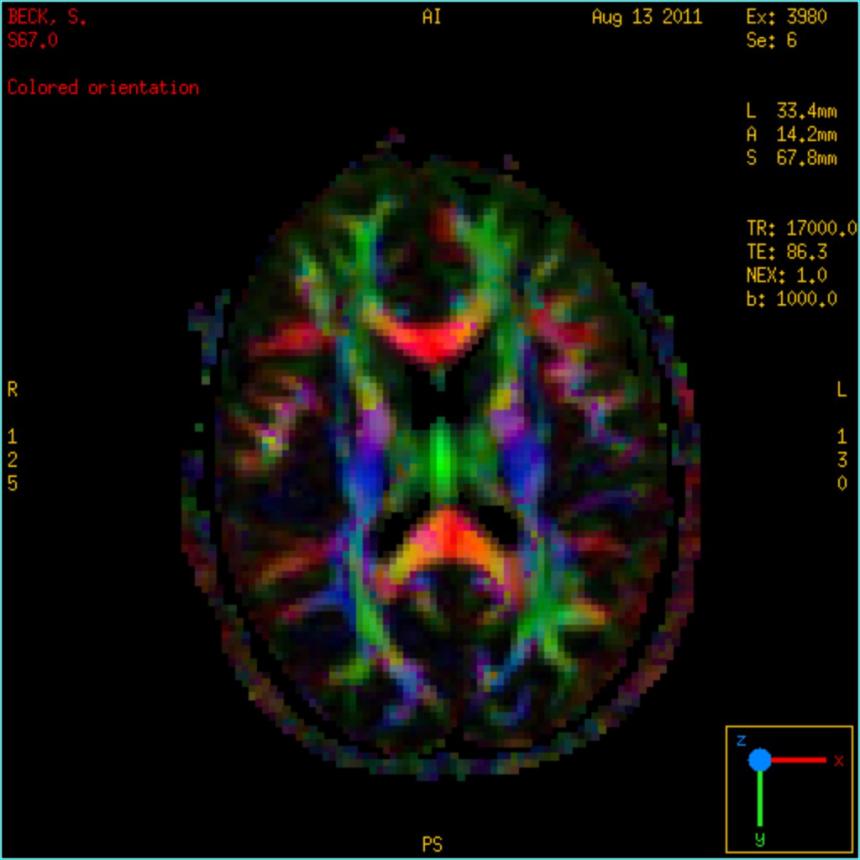 Brain imaging